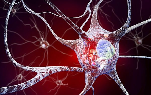 A novel tool to help gain deeper insight into Parkinson’s disease