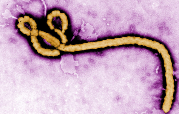 ebola virus